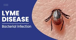Lyme Disease Threat is Here